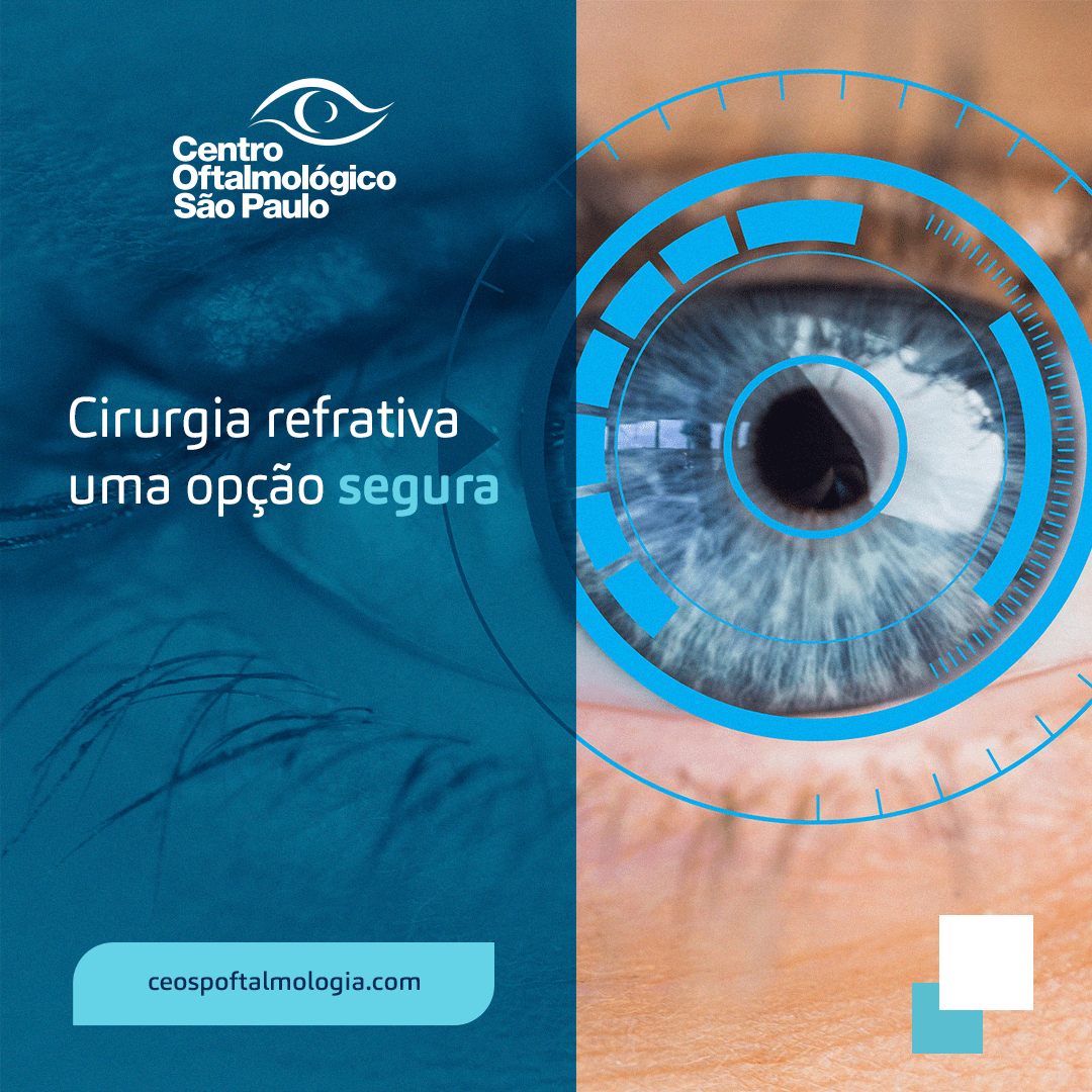 Cirurgia Refrativa, uma opção com segurança