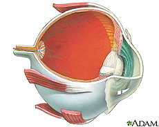 Retinal Implant Trial Helps Blind People See Shapes, Objects