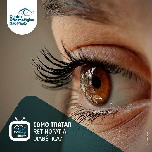 Como tratar a retinopatia diabética