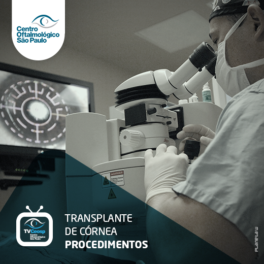 Transplante de Córnea – Procedimentos