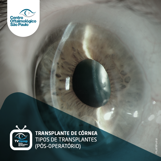 Transplante de Córnea Tipos de Transplantes (Pós-operatório)