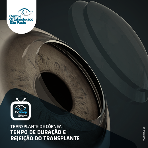 Transplante de Córnea – Tempo de duração e rejeição do transplante