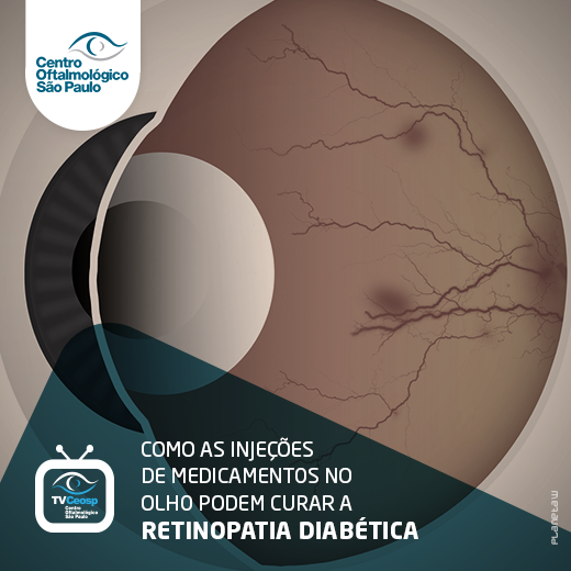 Como as injeções de medicamentos no olho podem curar a retinopatia diabética