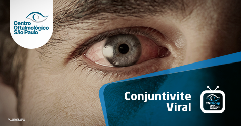 Conjuntivite Viral