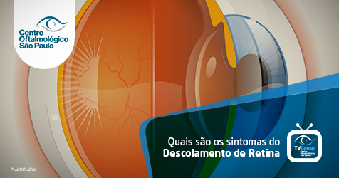 Quais são os sintomas do Descolamento de Retina