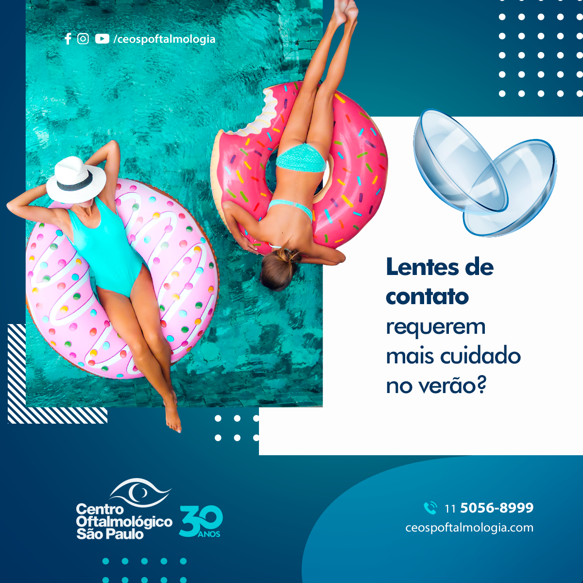 Lentes de contato requerem mais cuidado no verão?