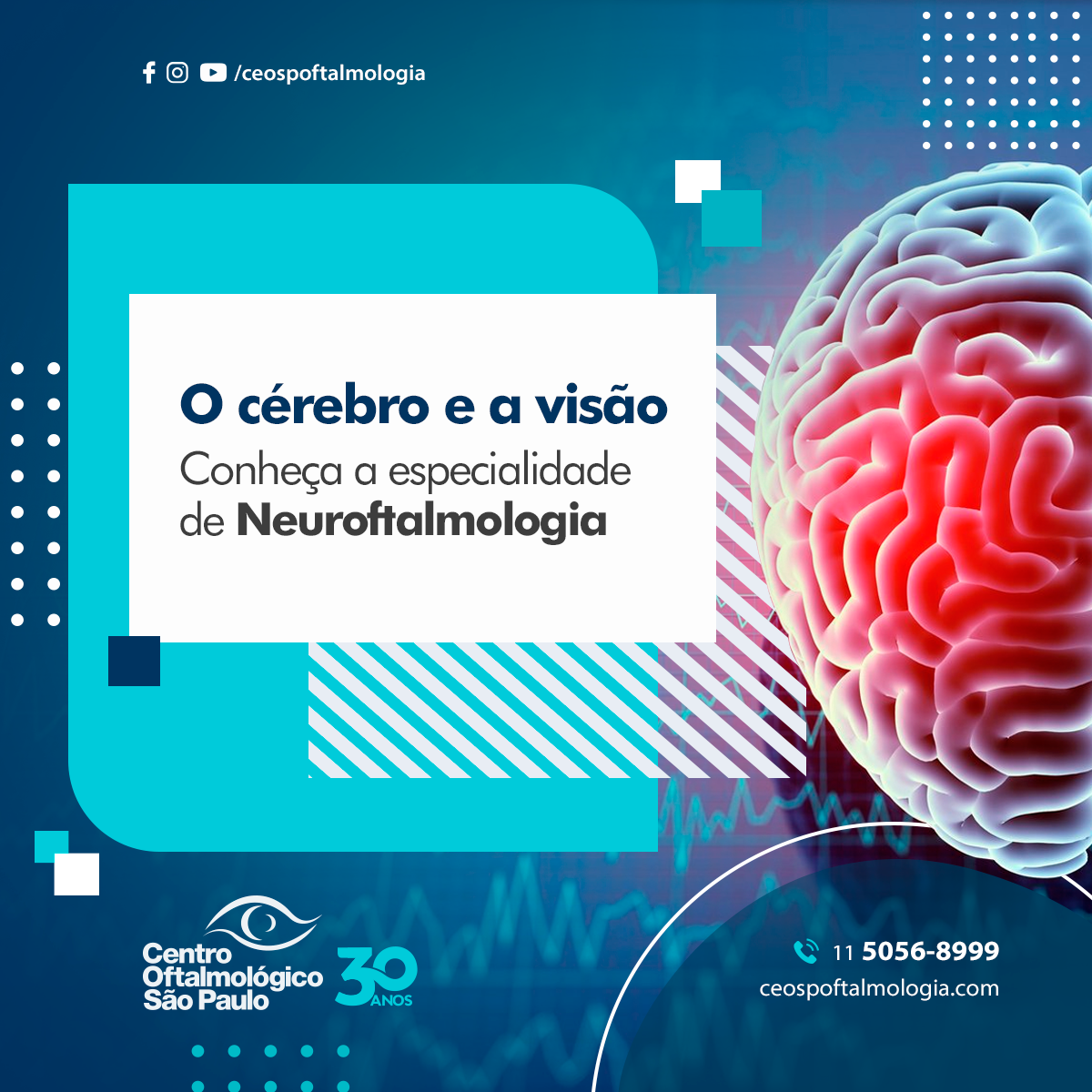 O cérebro e a visão. Conheça a especialidade de Neuroftalmologia