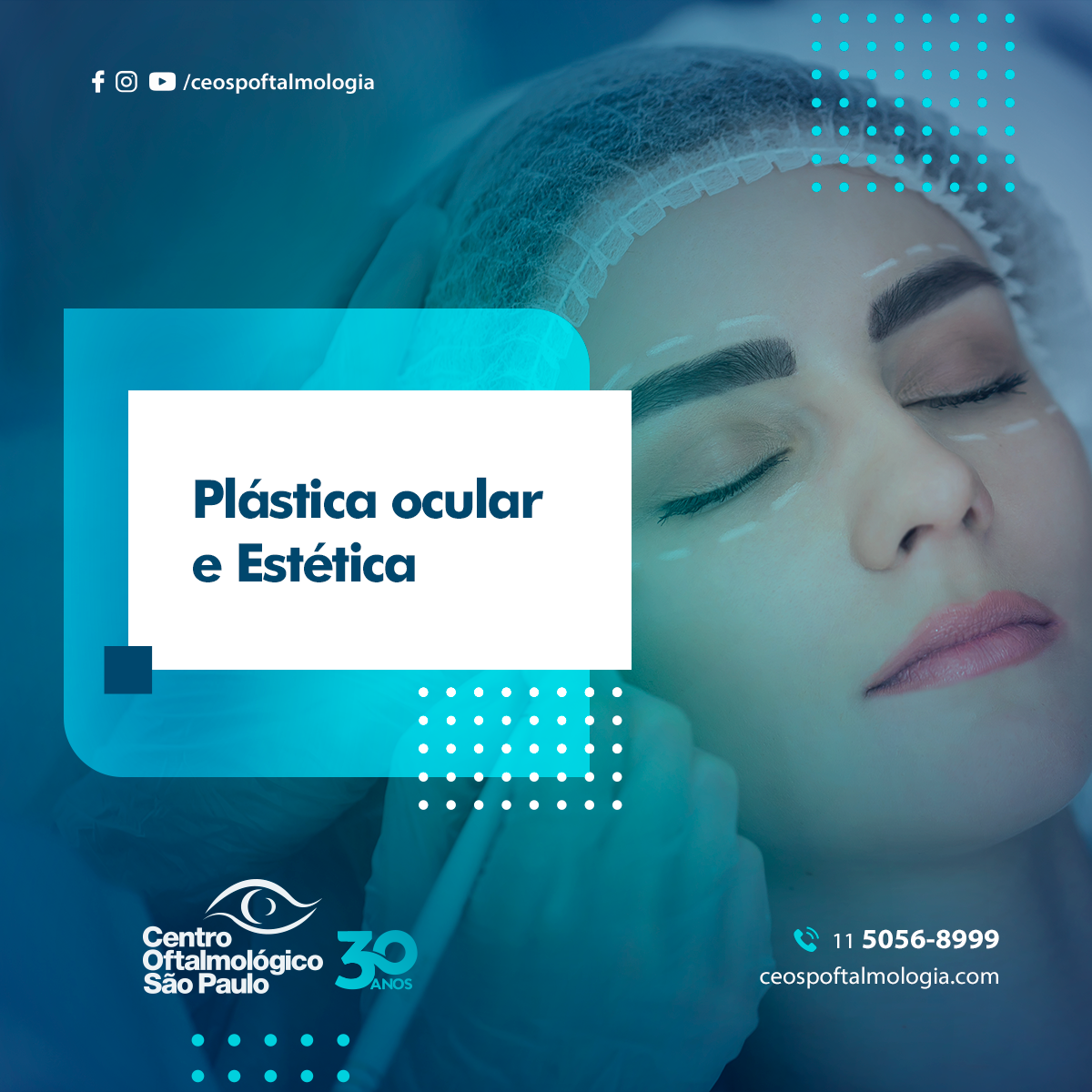 Plástica Ocular e estética