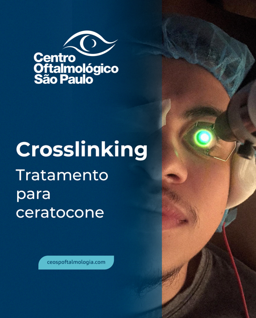 CrossLink – Tratamento para ceratocone